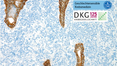 Leitthema: Non-Hodgkin-Lymphome - Titelbild