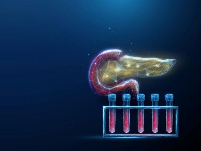 Image is an abstract illustration of a human pancreas and a rack of test tubes filled with blood depicting the concept of health screening 