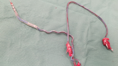 Leitthema: Chirurgische Perspektiven der Rhythmustherapie