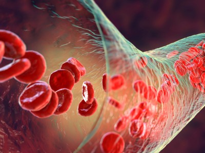 Podcast mit Partnern - Novartis Pharma GmbH: Polycythaemia vera