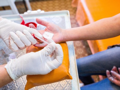 Point of Care Test auf HIV