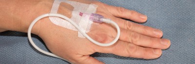 Intravenöse Verabreichung von Propofol