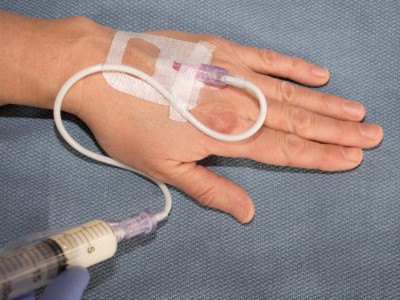 Intravenöse Verabreichung von Propofol
