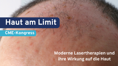 Aktinische Keratose am Kopf