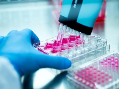 Pipettieren einer Lösung im Labor
