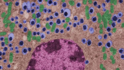 Image is a false color transmission electron microscopy micrograph of a beta cell of an islet of Langerhans showing typical insulin granules, mitochondria, and nucleus