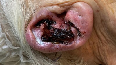 Befund am Ohr der älteren Patientin