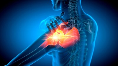 This image is a x-ray style illustration of an inflamed shoulder joint 