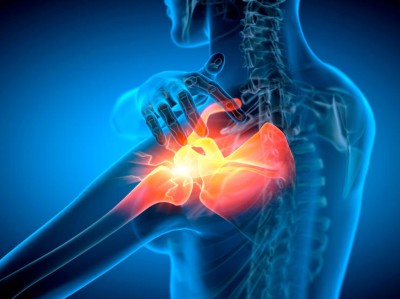This image is a x-ray style illustration of an inflamed shoulder joint 