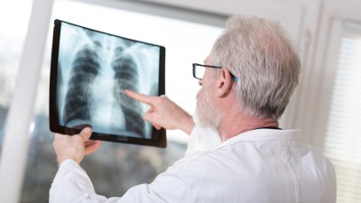 Arzt untersucht Röntgen