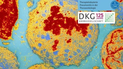 Leitthema: Oligometastasierung - Titelbild