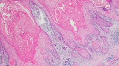 Histologie einer Schleimhautzelle