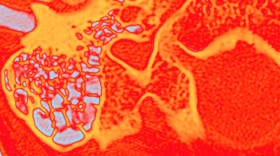 Leitthema: Felsenbein - Titelbild