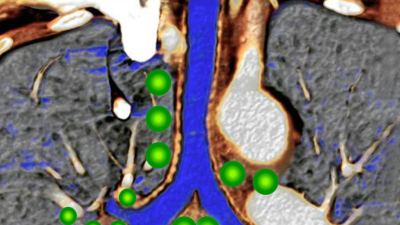 Leitthema: Lungenbeteiligung im Rahmen systemischer Erkrankungen - Titelbild