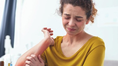 Frau mit Ausschlag kratzt sich am Arm