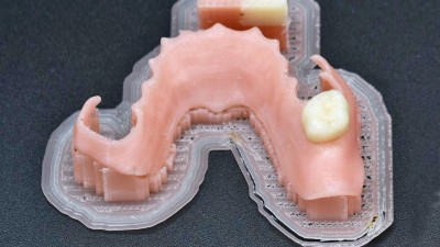 Mittels Multimaterial-MEX(Materialextrusion)-Verfahren gefertigte Klammerprothese nach dem Druckprozess. Der obere rechteckige Körper ist der „Wastetower“, der beim Fertigen entsteht.