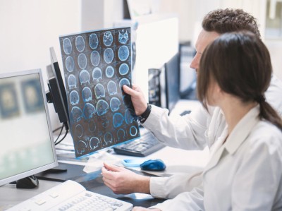 Radiologen untersuchen MRT-Scan eines Gehirns