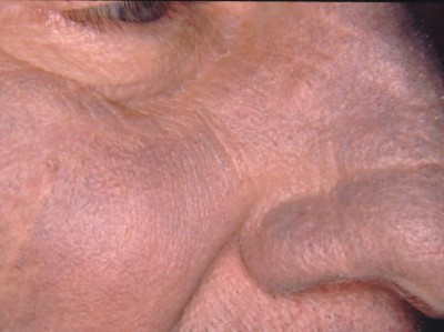 Im Gesicht ganz grau geworden