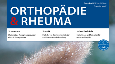 Orthopadie Rheuma Springermedizin De