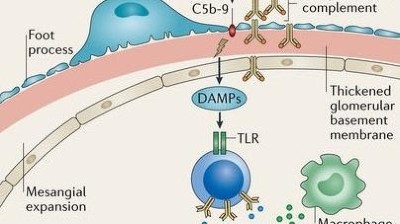 Type 2 Diabetes Mellitus Guide Causes Symptoms And