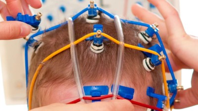 Clomifen im internet bestellen