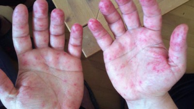 Blickdiagnosen | Die Diagnose liegt auf der Hand – oder ...