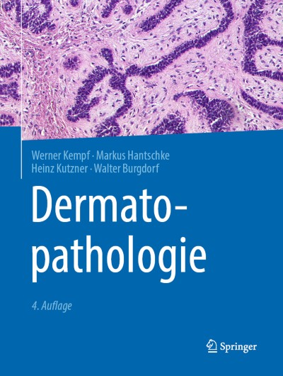 Weichteilhyperplasien und -neoplasien