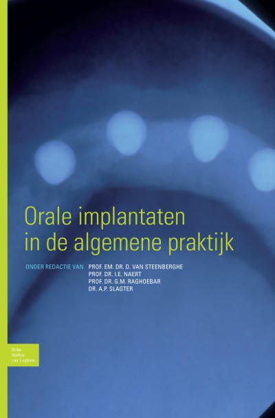 Link to Boek Orale implantaten in de algemene praktijk