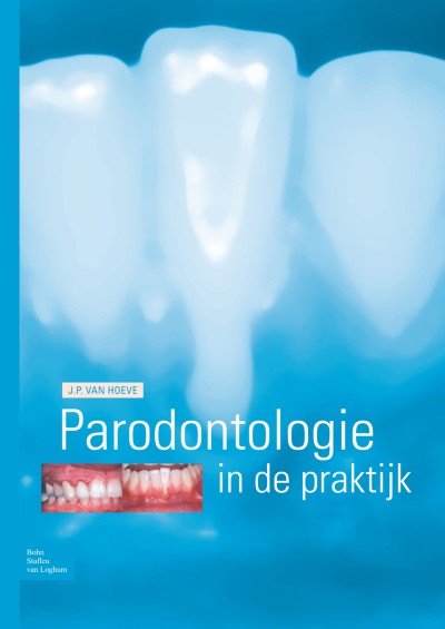 Cover of Boek Parodontologie in de Praktijk