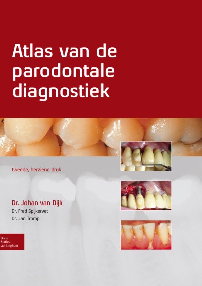 Link to Boek Atlas van de parodontale diagnostiek