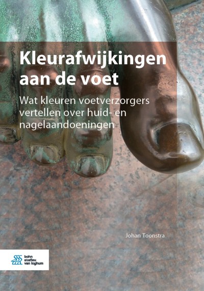 Link to Boek Kleurafwijkingen aan de voet