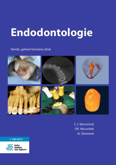 Cover of Boek Endodontologie