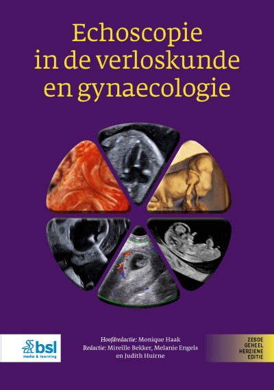 Link to Boek Echoscopie in de verloskunde en gynaecologie