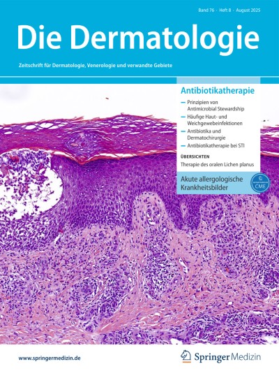 Übersicht zur Klinik, Diagnostik und Therapie von akuten allergologischen Krankheitsbildern