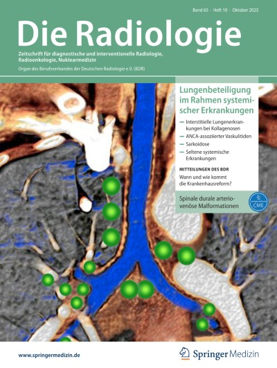 Spinale durale arteriovenöse Malformationen