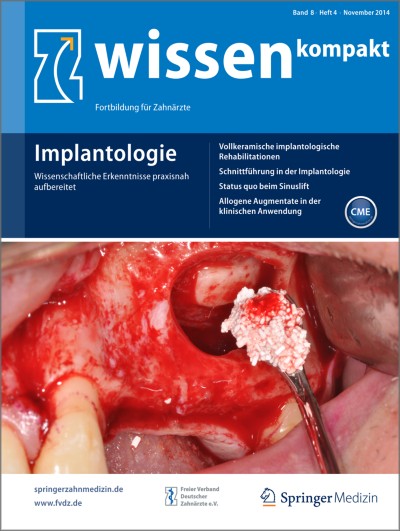 wissen kompakt 4/2014