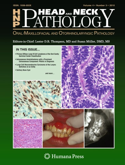 Intranasal Eosinophilic Angiocentric Fibrosis: A Case Report and Review ...