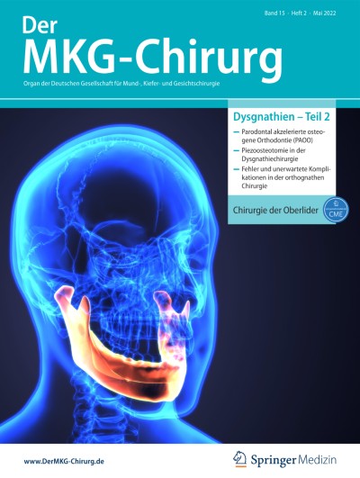 Der MKG-Chirurg 2/2022