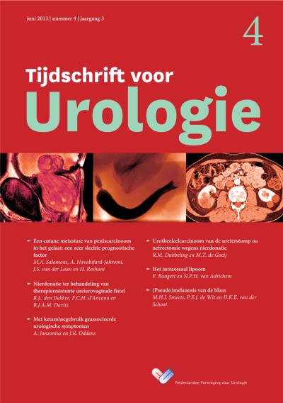 Tijdschrift voor Urologie 4/2013