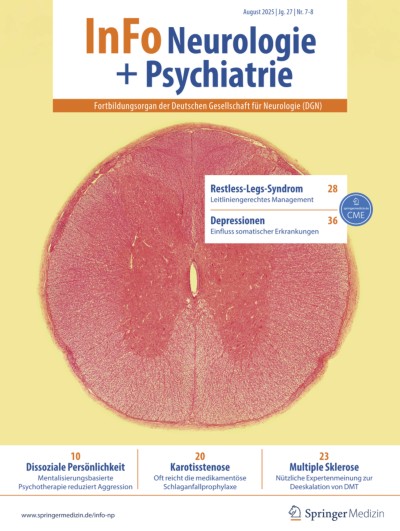 Fitnesstraining bessert Arbeitsgedächtnis