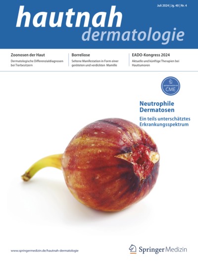 hautnah dermatologie 4/2024