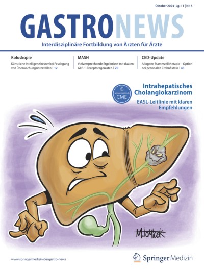 Das intrahepatische Cholangiokarzinom als eigenständige Entität