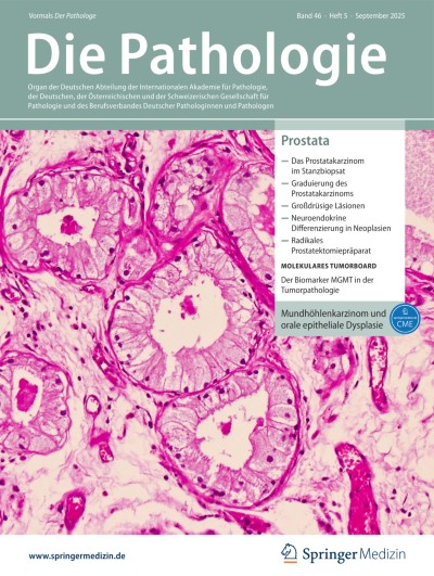 Das morphologische und klinische Spektrum von großdrüsigen Läsionen innerhalb der Prostata