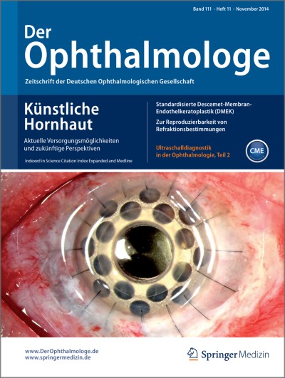 Knstliche Hornhaut | springermedizin.de