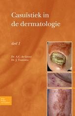 Casuïstiek in de dermatologie deel I | mijn-bsl