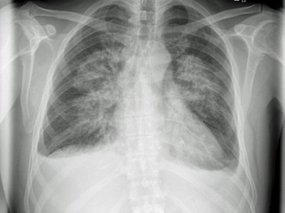 Pneumologie Pneumologie Springermedizin De
