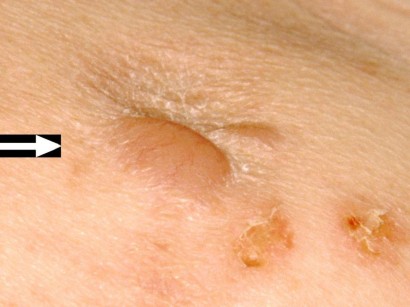 Dermatologische Diagnostik Dermatologische Diagnostik Springermedizin De