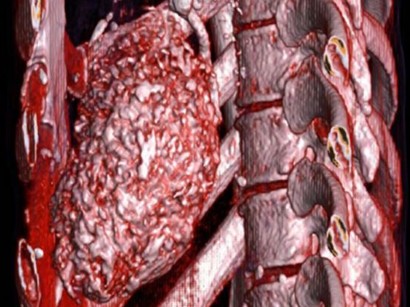 Sondernewsletter Rechtsmedizin Vom 29 04 2018 Springermedizin De