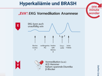 Covid 19 Reanimationsleitlinien Des Erc Springermedizin De