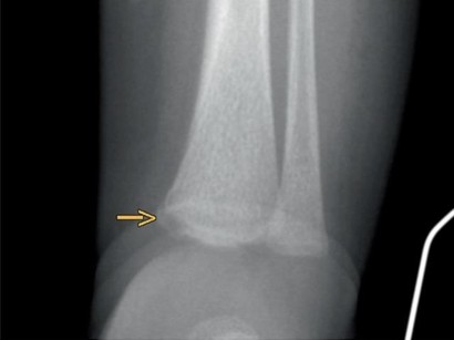 Diagnostische Radiologie Diagnostische Radiologie Springermedizin De